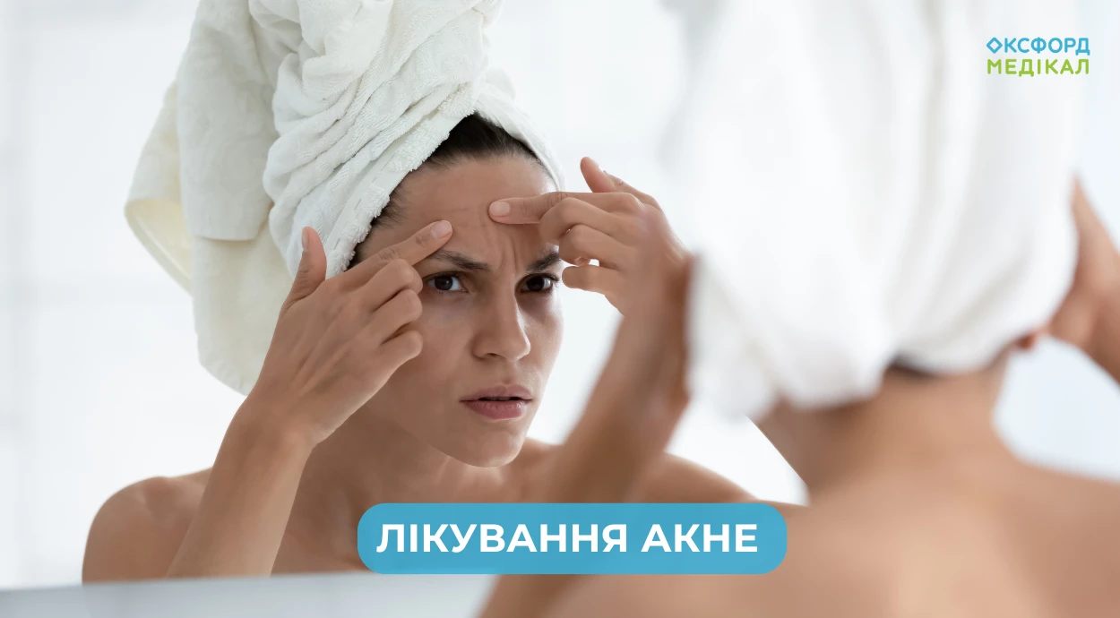 Лечение акне