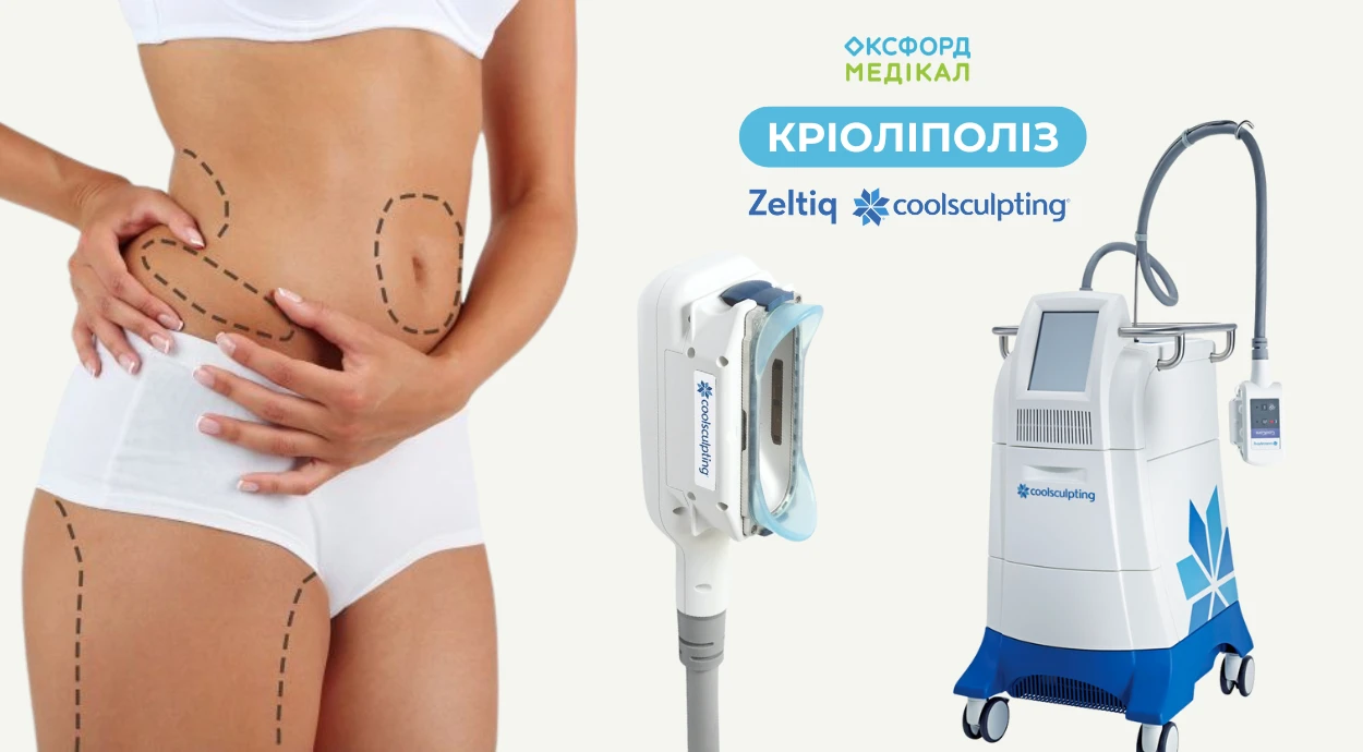 Криолиполиз – безоперационная липосакция!