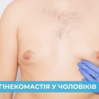 Гинекомастия-проблема которая имеет решение!